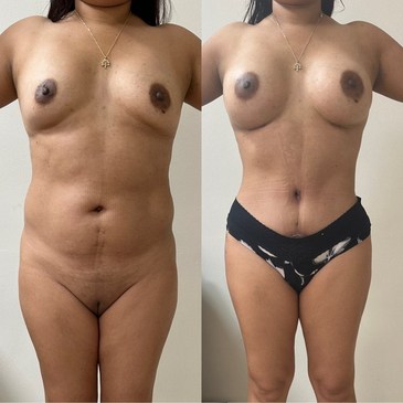 Slider image (9) Dr. Gabriel Sandoval - Plastic Surgeon in Mexico